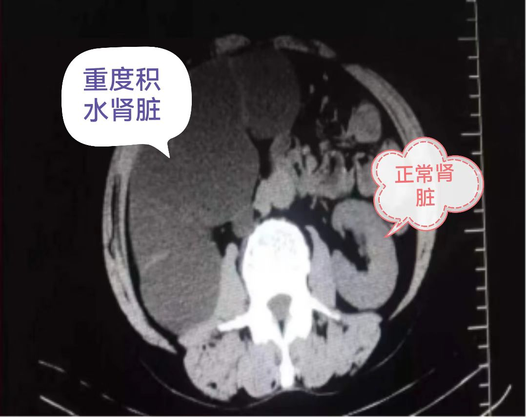 图片1(17).png